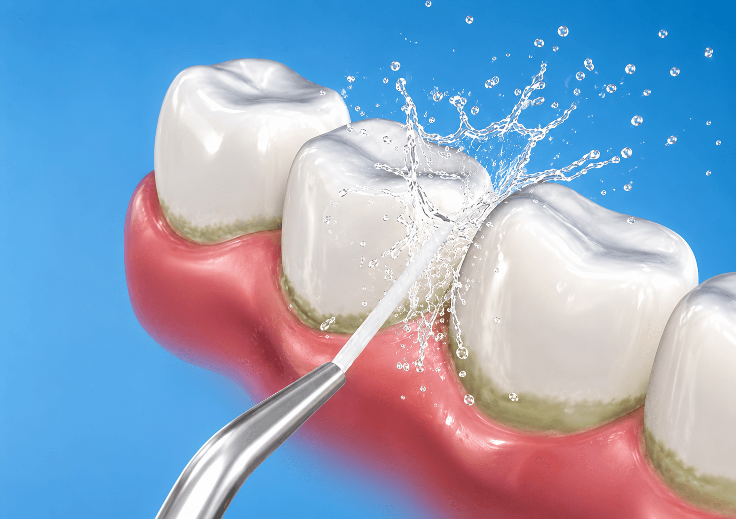 Retainer Hygiene